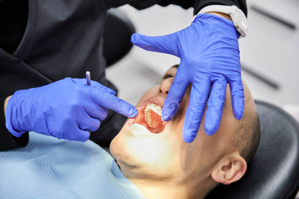 Best Emergency Tooth Extraction in Cambridge, NE