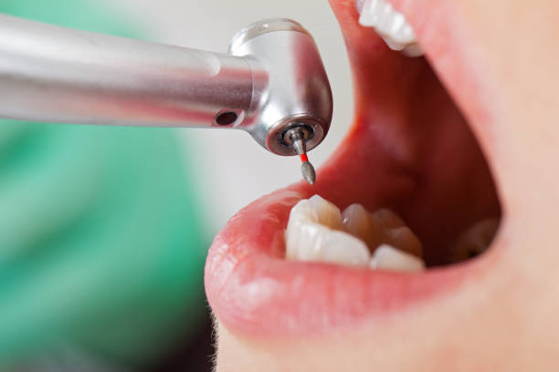 Best Emergency Denture Repair in Cambridge, NE
